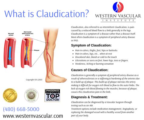 Define claudication - 2585 Samaritan Drive. Floor 2. San Jose, CA 95124. Vascular Care Clinic in Emeryville. 5800 Hollis Street. Emeryville, CA 94608. Phone: 510-806-2100. Intermittent claudication treatment aims to lower risk factors. Learn about smoking cessation, exercise, treatment of related medical problems, and medications.